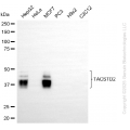 KD-Validated TACSTD2 Rabbit mAb (20 μl)