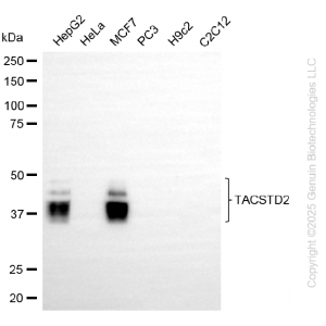 KD-Validated TACSTD2 Rabbit mAb (20 μl)
