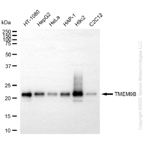 KD-Validated TMEM9B Rabbit mAb (20 μl)