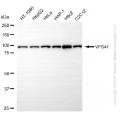 KD-Validated VPS41 Rabbit mAb (20 μl)