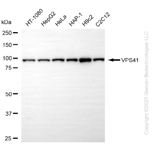 KD-Validated VPS41 Rabbit mAb (20 μl)