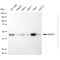 KD-Validated NR2F2 Rabbit mAb (20 μl)