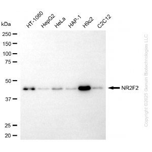 KD-Validated NR2F2 Rabbit mAb (20 μl)