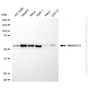 KD-Validated SMARCD1 Rabbit mAb (20 μl)