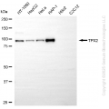 KD-Validated TPX2 Rabbit mAb (20 μl)