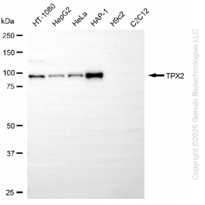 KD-Validated TPX2 Rabbit mAb (20 μl)