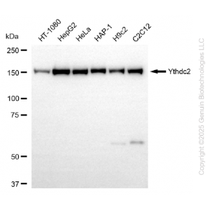 KD-Validated YTHDC2 Rabbit mAb (20 μl)