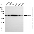 KD-Validated YTHDF1 Rabbit mAb (20 μl)