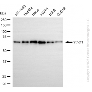 KD-Validated YTHDF1 Rabbit mAb (20 μl)