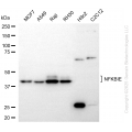 KD-Validated NFKBIE Rabbit mAb (20 μl)