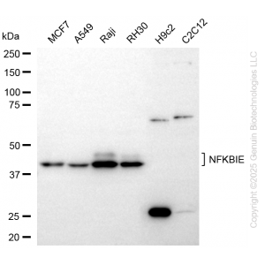 KD-Validated NFKBIE Rabbit mAb (20 μl)