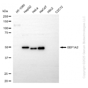 KD-Validated EEF1A2 Rabbit mAb (20 μl)