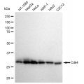 KD-Validated Cdk4 Rabbit mAb (20 μl)