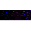 KD-Validated EphB4 Rabbit mAb (20 μl)