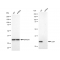KD-Validated Cdk4 Rabbit mAb (20 μl)