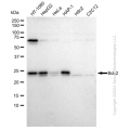 KD-Validated BCL2 Rabbit mAb (20 μl)