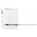 KD-Validated VAMP2 Rabbit mAb (20 μl)