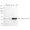 KD-Validated ACTSA Rabbit mAb (20 μl)