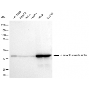 KD-Validated ACTSA Rabbit mAb (20 μl)