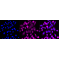KD-Validated PRKRA Rabbit mAb (20 μl)