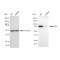 KD-Validated IKK alpha Rabbit mAb (20 μl)