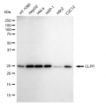 KD-Validated CLPP Rabbit mAb (20 μl)