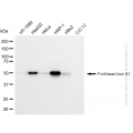 KD-Validated FOXA1 Rabbit mAb (20 μl)