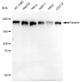 KD-Validated Tuberin Rabbit mAb (20 μl)