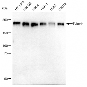 KD-Validated Tuberin Rabbit mAb (20 μl)