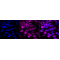 KD-Validated ACAT Rabbit mAb (20 μl)