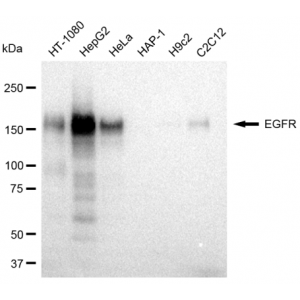 KD-Validated EGFR Rabbit mAb (20 μl)