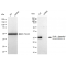 KD-Validated CDKN1B Rabbit mAb (20 μl)