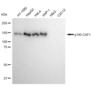 KD-Validated p150 CAF1 Rabbit mAb (20 μl)
