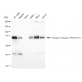 KD-Validated Phospho-PKR (T451) Rabbit mAb (20 μl)