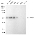 KD-Validated RING1 Rabbit mAb (20 μl)