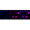 KD-Validated Phospho-PKC alpha (Ser657) Rabbit mAb (20 μl)