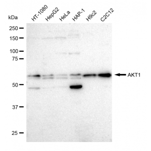 KD-Validated AKT1 Rabbit mAb (20 μl)