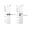 KD-Validated AKT1 Rabbit mAb (20 μl)