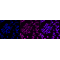 KD-Validated Bmi1 Rabbit mAb (20 μl)