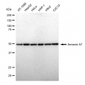 KD-Validated ANX7 Rabbit mAb (20 μl)