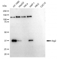 KD-Validated Arg2 Rabbit mAb (20 μl)