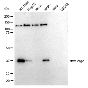 KD-Validated Arg2 Rabbit mAb (20 μl)