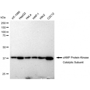 KD-Validated PKACA Rabbit mAb (20 μl)