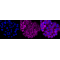 KD-Validated RRM1 Rabbit mAb (20 μl)