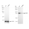 KD-Validated RRM1 Rabbit mAb (20 μl)