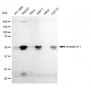 KD-Validated ARRB1 Rabbit mAb (20 μl)