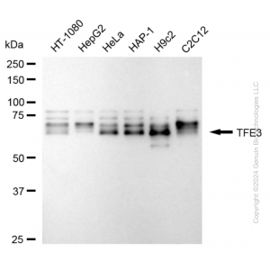 KD-Validated TFE3 Rabbit mAb (20 μl)