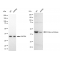KD-Validated Citrate Synthetase Rabbit mAb (20 μl)