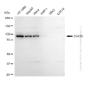 KD-Validated STAT6 Rabbit mAb (20 μl)