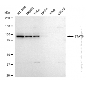 KD-Validated STAT6 Rabbit mAb (20 μl)